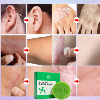 112-ezgif.com-resize.png